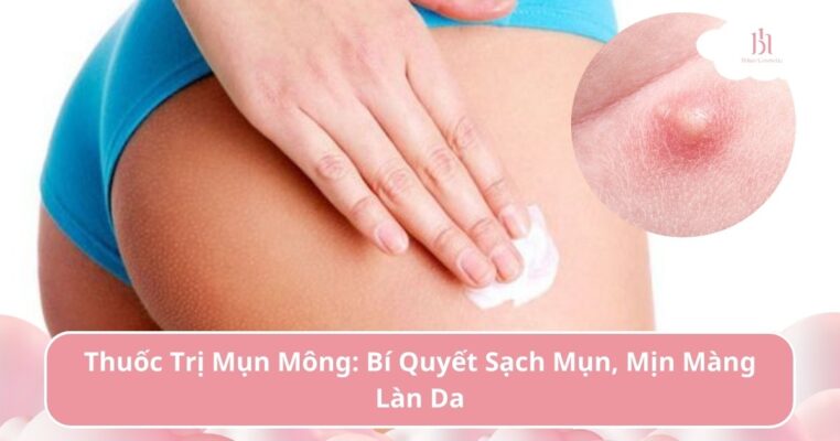 thuốc trị mụn mông